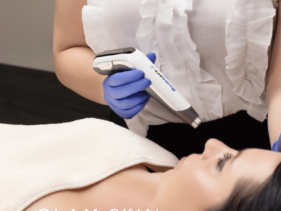 Dermapen 4 behandeling in Enschede